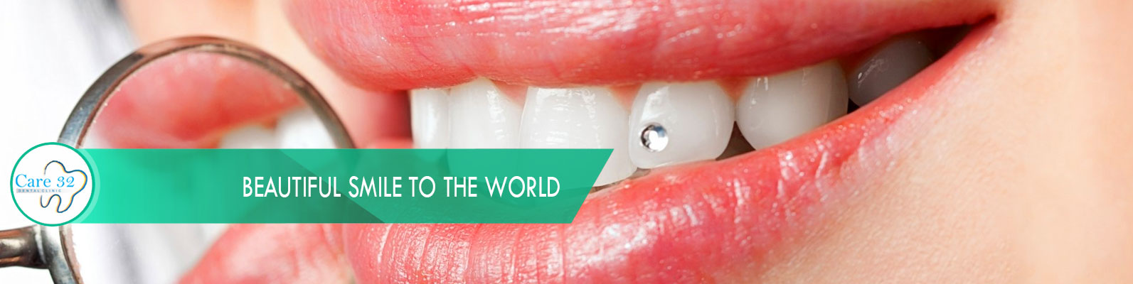 Dental-Jewellery-Mumbai-Andheri